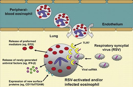 Eosinophils extravasate from the peripheral blood into the lung during RSV infection. The details of how the virus regulates the recruited eosinophils to help combat the infection remain to be determined. Phipps and coworkers show that some TLR-7 is present on the outer surface of the mouse eosinophil. However, most TLR-7 resides inside the cell, presumably in an endosomal and/or lysosomal compartment. Once viral ssRNA comes in contact with TLR-7, activation of an IRF7-dependent signaling pathway occurs, which eventually results in the release of the cell's preformed granule mediators (eg, EPX) and newly generated cytokines (eg, IFN-β) that contributeto the host's antiviral response. The activated eosinophil also increases its expression of important surface proteins like CD11b/ITGAM.