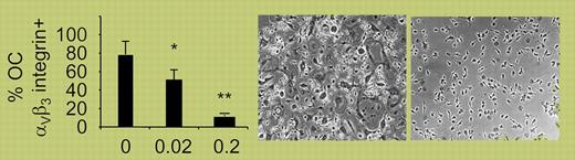 AZD6244 blocks osteoclast formation and transcripts of osteoclast-stimulating factors in MM cells. *P < .05; **P < .005; data represent the mean of 3 experiments (± SE). See the complete figure in the article beginning onpage 1656.