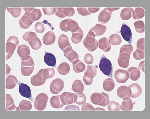 Peter Maslak, Sloan-Kettering Cancer Center