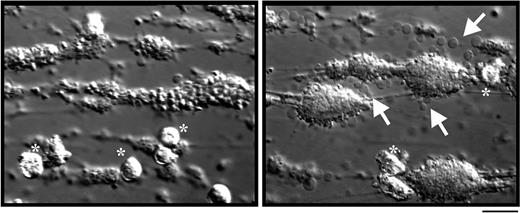 Figure 2. Neutrophil spreading occurs on spatially distinct areas of collagen thrombi. Citrated whole blood was perfused over a collagen (2 mg/mL) matrix for 5 minutes at 1800 s−1 to obtain platelet thrombi. Nonadherent platelets were removed by a further 5-minute perfusion with cell-free unsupplemented Tyrode buffer at 1800 s−1 followed by perfusion of isolated neutrophils (1 × 106/mL) in Tyrode buffer supplemented with 1 mM CaCl2/MgCl2 for 5 minutes at 150 s−1. Neutrophil-thrombus interactions were visualized by differential interference contrast (DIC) microscopy at a high (at the apex of thrombi; image on left) or low (to image the sides of thrombi; image on right) focal plane. These images are from 1 experiment representative of more than 10 independent experiments. Neutrophils in images are identified by asterisks. Arrows indicate the presence of SCIP, particularly prominent around the side of the thrombi. Bar represents 30 μm.