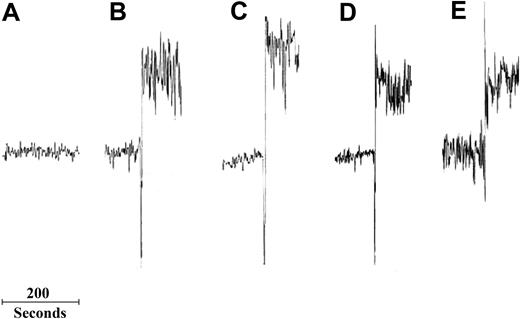 Figure 4. Effect of Dex on anti–GPIIIa-49-66 Ab– or Ca2+ ionophore–induced intracellular Ca2+ flux. Control or patient IgG (25 μg/mL) was added to fura-2 AM–loaded gel-filtered platelets and fluorescence monitored for 20 minutes. Ca2+ flux was determined from fluorescence ratios following excitations at 340 and 380 nm and fluorescence detection at 510 nm. (A) Control. (B) Anti–GPIIIa49-66. (C) Ab + Dex. (D) Ca2+ ionophore. (E) Ca2+ ionophore + Dex (n=3).