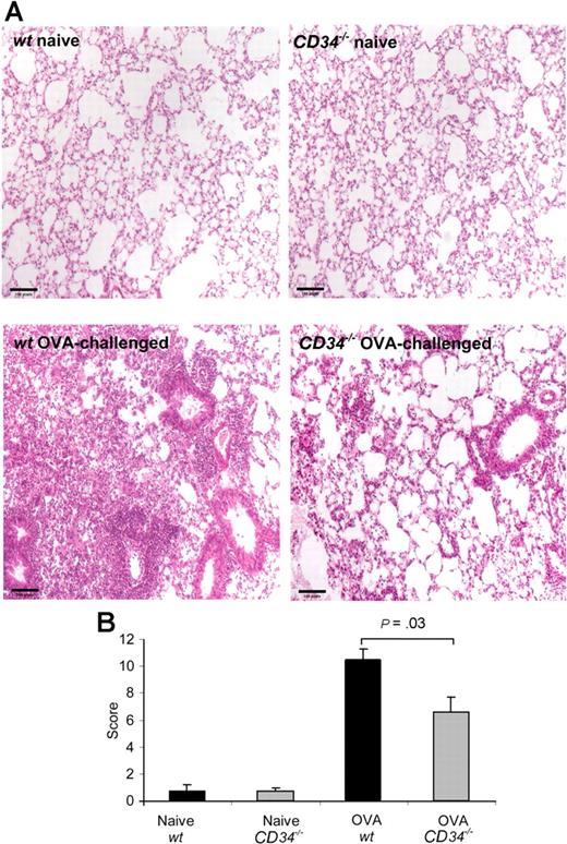 Figure 2. H&E-stained lung sections from naive and challenged mice. Lung sections were fixed in 10% formalin 24 hours after the last OVA challenge. (A) naive wt mouse, naive CD34−/− mouse, OVA-challenged wt mouse, and OVA-challenged CD34−/− mouse. (B) Mean histologic scoring of peribronchial, perivascular, and parenchymal infiltration and epithelium damage (n=6). A score of 1 to 5 (0=no sign of disease, 5=profound inflammation) for each parameter was blindly attributed after analysis of 5 fields from each sample. Error bars represent SEM on mean score for each group.