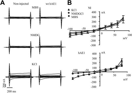 Figure 2. Current recordings of noninjected oocytes or oocytes expressing wt hAE1. (A) The representative electric signal of oocytes (noninjected or injected with wt hAE1 cRNA) measured during voltage clamp protocol either in regular MBS or MBS devoid of Na+. Na+ was substituted by impermeant cation NMDG or by K+. (B) Current-voltage curves obtained with control oocytes (noninjected) or oocytes injected with wild-type hAE1 2 days after injection. The current values were taken at 500 ms. The currents were recorded in control medium (MBS, black diamonds) or in MBS where Na+ was substituted by NMDG (◊), or by K+ (▲). Data presented are means (± SEM) of 20 oocytes coming from different batches.
