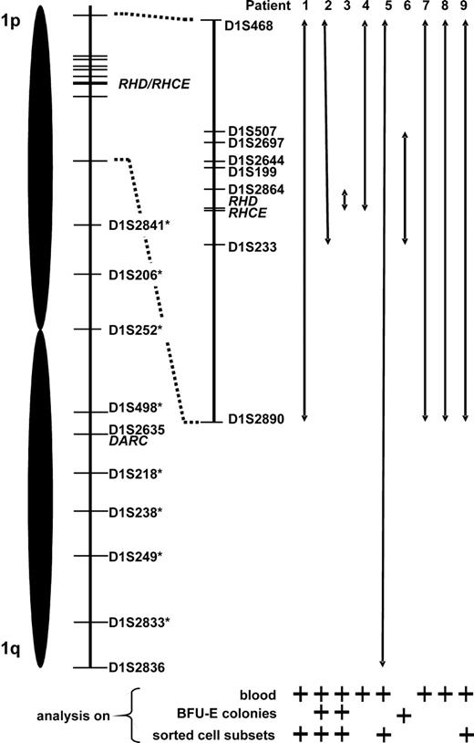 Figure 5. Proposed minimum expansion of loss of heterozygosity (LOH) on chromosome 1. Relative positions of the studied microsatellite markers as well as of the RHD/RHCE and DARC gene loci are depicted. Chromosome 1 stretches apparently affected by LOH are represented by double arrows. This data compilation is based on results of microsatellite analysis of blood, erythropoietic blast-forming units (BFU-Es), and sorted blood cell subsets; for each patient, lines of evidence are specified below the arrows. In patient 5, LOH appeared to span the entire chromosome 1 (markers with an asterisk were analyzed only in patient 5).