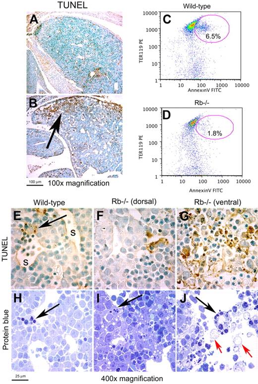 Figure 1. Localized necrotic cell death in Rb-null fetal liver. (A-B) TUNEL immunohistochemistry on sagittal sections of wild-type and Rb-null E13.5 fetal liver. (C-D) Representative flow cytometric analysis of annexin-V and TER119 staining on disaggregated whole E13.5 fetal liver from wild-type (C, 7.1% ± 0.6%, P < .002) and Rb-null (D, 2.8% ± 1.0%, P < .002) embryos to detect phosphotidyl serine externalization. (E-G) TUNEL staining for DNA fragmentation of wild-type (E) and Rb-null (F-G) E13.5 fetal livers (1000× magnification). The arrow in panel E identifies a phagocytic macrophage and s indicates a liver sinusoid. The dorsal region of the Rb-null fetal liver (F) shows markedly less TUNEL positivity than the ventral end of the liver that is distant from the hepatic vasculature. (H-J) Protein blue staining of sections of E13.5 wild-type fetal liver (H), more dorsal, healthy regions of the Rb-null fetal liver (I), and dying regions in the ventral end of the Rb−/− fetal liver (J) with black arrows indicating the presence of phagocytic macrophages and red arrows indicating distended, remnant nuclei. See ″Fluorescence microscopy and island counts″ for image acquisition information.