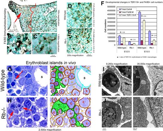 Figure 2. Rb-null macrophages are competent for erythroblast interactions in vivo. (A-C) Immunohistochemical staining for F4/80 on Rb-null fetal liver showing the increased numbers of F4/80+ macrophages accumulating in the distal tip of the liver (red arrow, B), and the difference in staining of F4/80 in healthy regions of the liver to the right of the red line (D) compared with dying and ischemic regions of the liver to the left of the red line (C). (D-E) F4/80 immunohistochemistry on intact Rb-null (F) and wild-type (E) fetal liver with F4/80-positive surface area determined by optical densitometry for DAB positivity. (F) Graphic representation of total fetal liver cell number, number of F4/80-positive macrophages, number of TER119-positive erythroblasts, and ratio of TER119-positive erythroblasts to F4/80-positive macrophages in wild-type and Rb-null fetal livers at E12.5 and E13.5. At E12.5, F4/80-positive macrophages represented 13.2% (± 2.7%) and 15.4% (± 0.9%) of total cell number for wild type and Rb null, respectively, and 13.4% (± 4.0%) for wild-type and 12.2% (± 0.4%) for Rb null at E13.5. (G-H) Protein blue-stained E13.5 wild-type (H) and Rb-null (I) fetal livers showing erythroblastic islands in situ (left) with a color-coded key (right) to indicate distinct cell types, including macrophages (M, green), erythroblasts (E, red), hepatocytes (H, brown), endothelial cell (en, turquoise), and liver sinusoids (S). (I-J) Electron microscopy of macrophage-erythroblast contacts in E13.5 wild-type (J) and Rb-null (K) fetal liver. Erythroblasts (Ery), macrophages (Mac), and hepatocytes (Hep) were distinguished on the basis of mitochondrial size and numbers (hepatocytes have larger, more numerous mitochondria), nuclear and cytoplasmic electron density, and smaller cell size (erythroblasts) and larger cell size, cytoplasmic projections, and inclusion bodies (macrophages). See ″Fluorescence microscopy and island counts″ for image acquisition information.