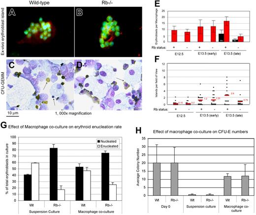 Figure 3. Macrophages are not required for erythroid enucleation. (A,B) Native erythroblast islands from disaggregated wild-type (left) or Rb−/− (right) E12.5 fetal liver were examined 16 hours after culture, using anti-F4/80 to stain macrophages (red) and anti-TER119 (green) to stain erythroblasts, and Hoechst 33342 for DNA, indicating no difference in island formation between wild-type and Rb-null-derived cells. (C,D) High-magnification analysis of the interaction between red cells (benzidine-stained brown cells) and macrophages (large “foamy” cells) is examined in the context of 12-day CFU-GEMM colony differentiation derived from wild-type (C) or Rb-null (D) fetal liver progenitors. We noted that Rb-null erythroblasts (D) failed to enucleate irrespective of macrophage contacts (arrow) and demonstrated increased size and abnormal chromatin structure as reported previously.11,12 (E,F) Native erythroblast islands cultured in vitro from mice with the indicated Rb genotypes and at early or later stages of embryonic development were enumerated (F). Only definitive islands in which 5 or more erythroblasts were bound were counted as islands. Numbers of erythroblasts per macrophage were also counted (E). Experiments were carried out in triplicate. Error bars are standard deviations. Significant differences were observed for the number of erythroblasts per macrophage in “late” E13.5 wild-type and Rb-null fetal liver after 4 hours (P = .001) or 16 hours (P = .001) in culture (E). Student t test. (G) Quantitation of enucleation by flow cytometric analysis of all erythroid cells (floating and attached) was carried out after 60 hours in culture, either in the presence of macrophages and erythroblast island formation or in suspension culture. The percentage of enucleated Rb-null cells was significantly reduced relative to wild type in suspension culture (P < .009) and in macrophage coculture (P < .003). (H) Purified erythroblast progenitors from E12.5 fetal livers were cultured for 48 hours in adherence with macrophages or in suspension culture, and then harvested for CFU-E assay in methylcellulose. Viable cells (250) were plated in triplicate per sample. Numbers of CFU-Es formed were compared with cultures seeded with erythroblasts recovered after only 90 minutes in culture (day 0). See ″Fluorescence microscopy and island counts″ for image acquisition information.