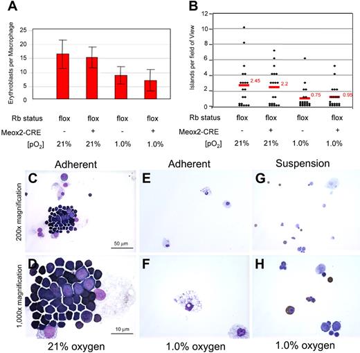 Figure 5. Hypoxia disrupts erythropoietic islands. (A,B) The effect of hypoxia on erythropoietic island numbers and numbers of erythroblasts per macrophage was quantified as described previously (Figure 3E,F). Hypoxia had a greater effect on both island integrity and numbers of erythroblasts per macrophage than did the Rb status of the cells. Differences in numbers of erythroblasts per macrophage as a function of oxygen tension (21% vs 1% O2) were significant in the absence of Cre expression (P < .001) and in the presence of Cre expression (P < .001). The numbers of islands formed at 21% compared with 1% O2 were also significant (P < .04 for Cre− and P < .02 for Cre+). Error bars represent standard deviation from the mean value for numbers of erythroblasts per island (A) and numbers of islands (B). (C-H) The effect of hypoxia on erythroblast island integrity was visualized by staining of adherent (C-F) and floating (G,H) cells from purified island cultures exposed to 21% oxygen for 36 hours (C,D) or to 21% oxygen for 18 hours and subsequently to 1.0% oxygen for 18 hours (E-H). Significant differences were observed for the number of erythroblasts per macrophage in E13.5 wild-type and Rb-null fetal liver after 4 hours (P = .001) or 16 hours (P = .001) in culture at 21% oxygen and between Rb-positive and Rb-deficient cultures derived from Rbflox mice when cultured at 1% oxygen versus 21% oxygen for 12 hours (P = .001 for Cre+; P = .001 for Cre−) but not between wild type and Rb null earlier in gestation or possessing a wild-type placenta (Rbflox;Cre+ vs Cre−). See ″Fluorescence microscopy and island counts″ for image acquisition information. (B) Island numbers were reduced in E13.5 Rb-null fetal liver compared with wild type (P = .01) and in conditionally targeted fetal livers following 16 hours at 1% oxygen when compared with normal tissue culture (P = .02 and P = .04, respectively) Notably, placental rescue increased Rb-deficient island number (P = .03; Student t test).