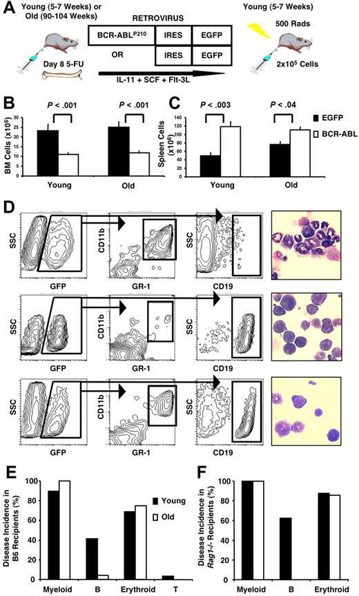 Figure 1. Age alters the phenotype of BCR-ABLP210–induced leukemia. (A) BM from young or old B6 mice was harvested on day 8 after 5-FU treatment, infected with a retrovirus carrying a bicistronic IRES expression vector encoding BCR-ABLP210 and a reporter EGFP gene, and transplanted into sublethally irradiated, young syngeneic or congenic recipients. Control recipients received BM transduced with EGFP alone. Leukemias were accompanied by decreased BM (B) and increased splenic (C) cellularity. Cell numbers represent mean values plus or minus SEM obtained from 5 independent experiments with 29 recipients of young BMBCR-ABL, 24 recipients of old BMBCR-ABL, 9 recipients of young BMEGFP, and 5 recipients of old BMEGFP. (D) Leukemic cells in the BM were characterized by flow cytometry for expression of GFP (BCR-ABLP210) in combination with lineage-specific cell-surface antigens. Examples of recipients with an MPD (top panels), B-lymphoid leukemia (middle panels), and both an MPD and lymphoid leukemia (bottom panels) are shown. Recipients that developed an MPD had increased granulocytes and decreased lymphocytes in the spleen (top right panel), whereas the ones that developed B-lymphoid leukemia had increased lymphoid cells and blasts in the spleen (middle right panel) compared with controls (× 400 magnification). Images were viewed with a Leitz Laborlux D microscope (Leitz, Wetzlar, Germany) using a 40×/0.70 NA phase-contrast objective. Cells were deposited onto slides with a cytocentrifuge (Shandon-Elliot, Sewickley, PA) and stained with Wright-Giemsa. Coverslips were mounted with Permount (Biomeda, Foster City, CA). Micrographs were taken using an Olympus DP11 camera (Olympus, Tokyo, Japan), and prepared using Adobe Photoshop image-acquisition software (Adobe Systems, San Jose, CA). (E,F) Summary of the incidence of leukemia according to phenotype in B6 (E) and Rag1−/− (F) recipients of young and old BMBCR-ABL cells. The data shown in panel E are based on the same recipients as those shown in panels B and C, and data shown in panel F are based on 8 recipients of young and 7 recipients of old BMBCR-ABL cells.