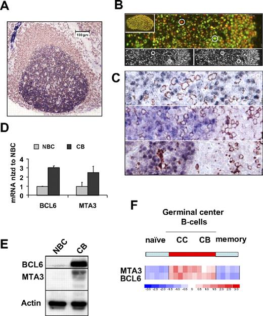 Figure 1. MTA3 is coexpressed with BCL6 exclusively within GC B cells. (A-C) Immunohistochemistry in lymphoid follicle with GC from human tonsil. A CD20 (brown) and MTA3 (blue). (B) Dual immunofluorescence in which MTA3 is labeled in red and BCL6 in green. Cells expressing both proteins display a yellow signal. The circles denote cells used as a reference in the lower 2 panels to demonstrate lack of bleed-through between the fluorescence channels. (C) MTA3 (blue in all 3 panels) along with either CD138 (plasma cell marker), CD3 (T-cell marker), and CD68 (histiocyte marker) respectively, all in brown. (D-F) Purified human tonsillar NBCs and CBs were assessed by (D) real-time PCR for BCL6 and MTA3 mRNA (where the y-axis depicts mRNA abundance normalized to the level found in NBCs). Error bars are SD. (E) Immunoblots with antibodies for MTA3, BCL6, and actin as loading control. (F) Expression microarray analysis visually represented here by a heat map of mRNA levels in NBCs, CCs, CBs, and memory B cells. The scale shows relative mRNA abundance (red = higher, blue = lower).