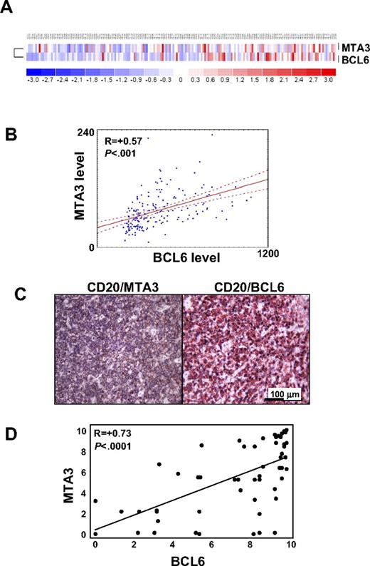 Figure 2. MTA3 and BCL6 expression are highly correlated in primary DLBCLs. (A) BCL6 and MTA3 expression was examined in a panel of 176 patients with DLBCL by expression microarray analysis. A heat map graphically representing BCL6 and MTA3 mRNA abundance is shown. (B) Scatterplot representation of correlation between BCL6 and MTA3 mRNA levels in all patients with DLBCL. The y- and x-axes correspond to mRNA levels in arbitrary units. The lines are regression line with confidence intervals (“Microarray expression analysis in human DLBCLs”). (C) Immunohistochemistry was performed in tissue microarrays (TMAs) containing 74 patients with DLBCL with BCL6, MTA3, and CD20 antibodies. Representative micrographs are shown of a DLBCL sample stained for BCL6 + CD20 or MTA3 + CD20 as labeled. (D) Scatterplot representation of correlation between BCL6 and MTA3 protein levels in all 127 patients with DLBCL. The y- and x-axes represent protein expression levels.