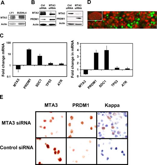 Figure 3. MTA3 depletion is associated with differentiation of DLBCL cells. (A) MTA3 Immunoblots were performed in LY1 and SUDHL4 DLBCL cell lines—actin is shown as loading control. (B) Immunoblots for MTA3, PRDM1, and actin performed in Ly1 cells (left) and SUDHL4 cells (right) transfected with MTA3 siRNA or ctrl siRNA. (C) MTA3 siRNA knockdown was performed in Ly1 (left panel) and SUDHL4 cells (right panel), followed in 24 hours by QPCR for the MTA3, PRDM1, SDC1, TP53, and ATR transcripts. The y-axis represents the fold change in mRNA abundance relative to the levels in wild-type and control siRNA–transfected cells. Error bars are SD. (D) Dual immunofluorescence of a human tonsillar GC with MTA3 (red) and PRDM1 (green) antibodies. The inset is the same GC at low-power magnification. (E) Ly1 cells were transfected with MTA3 or control siRNA and examined by immunohistochemistry for expression of MTA3, PRDM1, and κ light chains with corresponding antibodies.