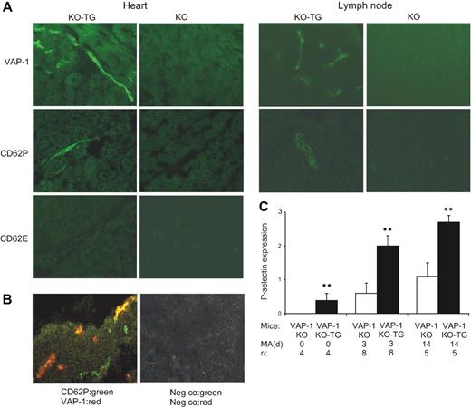 Figure 4. In vivo induction of endothelial P-selectin protein by VAP-1/SSAO. (A) VAP-1–deficient mice (KO) and VAP-1–deficient mice expressing human VAP-1 as a transgene (KO-TG) were fed 0.4% methylamine for 3 days in their drinking water. The expression of human VAP-1, mouse CD62P (P-selectin), and mouse CD62E (E-selectin) protein was stained using immunohistochemistry from the heart and mesenteric lymph node. (B) Partial overlap in VAP-1 and P-selectin expression (yellow) is seen in 2-color immunofluorescence images. (C) Quantitation of P-selectin expression in the mesenteric lymph nodes of VAP-1 KO mice and VAP-1 KO-TG mice that received methylamine (MA) in the drinking water for the indicated time period (days). Data (means ± SEM) are shown as semiquantitative scores ranging from 0 (negative) to 3 (high expression). n = number of mice per group. **P < .01.