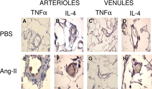 Figure 5. Representative photomicrographs showing immunolocalization of TNFα and IL-4 in rat mesenteric arterioles and postcapillary venules. Mesentery was fixed for staining with anti-TNFα (A,C,E,G) or IL-4 (B,D,F,H) antibodies 4 hours after the intraperitoneal injection of PBS (A-D) or Ang-II (1 nM; E-H). Brown reaction product indicates positive immunoperoxidase localization on the vascular endothelium. All panels are lightly counterstained with hematoxylin. Results are representative of 4 to 5 experiments with each treatment. A 100 × 1.25 oil objective lens was used. Leica IM 1000 software capture imaging (Leica Microsystems, Wetzlar, Germany) was used to obtain the images.