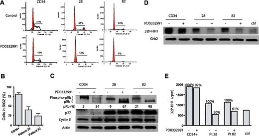 Figure 6. Effect of PD0332991 on primary AML cells. CD34+ and primary AML cells from patients 28 (Flt3 wt) and 82 (Flt3 ITD) were plated in methylcellulose and treated with PD0332991 (500 nM) or DMSO (vehicle control) for 4 days. The cells were fixed and stained with propidium iodide, and cell-cycle analysis was performed by flow cytometry. (A) Representative flow cytometric cell-cycle analysis of 1 experiment with CD34+ cells as well as cells from patients 28 and 82. (B) Bar graph analysis of the percentage of PD0332991-treated cells in S and G2 compared with control cells using data from 3 independent experiments (mean ± SE). (C) Western blot. CD34+ and primary AML cells from patients 28 and 82 were treated as in (A). Cell lysates were prepared and resolved by SDS/PAGE, and an immunoblot was performed with the indicated antibodies. (D) Cells were treated as in (panel A). Cell lysates were prepared and normalized by protein concentration. CDK2 was immunoprecipitated to perform the in vitro kinase assay. Incorporation of 32P in the CDK2 substrate histone H1 was assessed by SDS-PAGE followed by autoradiography. As a control for the specificity of the kinase assay, a lysate from CD34+ cells was incubated with an isotype-matched antibody to form an immunocomplex. To confirm equal protein amounts in each normalized extract, aliquots were separated by SDS-PAGE and analyzed by Western blot with an anti-Grb-2 antibody. (E) Quantitative representation of 32P-histone H1(cpm) of the experiment depicted in (panel D).