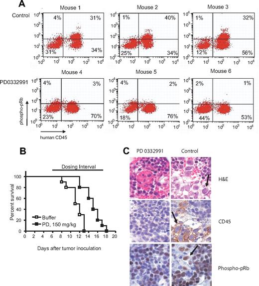Figure 7. AML mouse model to study the efficacy of PD0332991 in vivo. (A) Phospho-pRb staining in human CD45 cells. 6 NOD/SCID mice were inoculated with MOLM13 cells. On day 9 after inoculation, 3 mice were dosed with PD0332991 (150 mg/kg), and 3 mice were dosed with vehicle (lactic acid buffer). On day 10, the mice were dosed a second time with PD0332991 (150 mg/kg) or vehicle 4 hours before sacrificing them. The bone marrow was isolated, stained with anti-human CD45 plus anti-phospho-pRb, and analyzed by flow cytometry. The cells detected in the upper right and lower right quadrant are human leukemia cells because they stain positive for human CD45. The cells in the upper right quadrant stain positive for phospho-pRb. The cells in the lower right are negative for phospho-pRb. (B) Kaplan-Meyer survival plot. NOD/SCID mice were inoculated with MOLM13 cells. Starting on day 6 after inoculation, one group (10 mice) was dosed with PD0332991 (150 mg/kg), the other group (10 mice) was dosed with vehicle (lactic acid buffer). The survival of both groups was analyzed by Kaplan-Meyer plot. The survival benefit of mice treated with PD0332991 was statistically significant (P=.001, logrank test). (C) Immunohistochemistry. 10 NOD/SCID mice were engrafted as above. Five mice were each dosed with PD0332991 (150 mg/kg) or lactic acid buffer (control) starting on day 5 after inoculation. On day 10, all mice were killed. Sections of the sterna were prepared and stained as indicated with H&E, anti-human CD45, and anti-phospho pRb. The arrows point at the human leukemia cells. Images were visualized using an Olympus BX41 microscope equipped with an Olympus 3040 camera and a Plan 40×/0.65 NA objective lens (Olympus America, Melville, NY). The image medium was air. Adobe Photoshop CS version 8 (Adobe Systems, San Jose, CA) was used for image acquisition and processing.