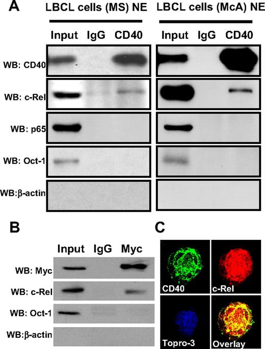 Figure 1. CD40 interacts with c-Rel in the nucleus of LBCL cells. (A) Coimmunoprecipitation assays were performed with the nuclear extracts of LBCL-MS and LBCL-McA cells. Nuclear extracts (1 mg) from LBCL cells (MS and McA) were immunoprecipitated with a polyclonal CD40 antibody or IgG antiserum (negative control) respectively. Immunoprecipitated complexes were resolved on SDS–polyacrylamide gel electrophoresis (PAGE), and subjected to Western blotting with anti–c-Rel, anti-p65, anti–Oct-1, and anti–β-actin antibodies. Input indicates 25 μg nuclear extract; NE, nuclear extract. (B) MS cells were cotransfected with expression vectors for c-Rel (pCMV-c-Rel) and CD40wt (pcDNA3.1/myc/his-CD40). Forty-eight hours after transfection, the nuclear fraction was extracted and immunoprecipitated with monoclonal anti-Myc tag antibody. Immunoprecipitates were then Western blotted with anti-Myc (detecting recombinant CD40), anti–c-Rel, anti–Oct-1, and anti–β-actin antibodies. Input indicates 25 μg nuclear extract. (C) LBCL cells (MS) were fixed with methanol and stained for CD40 (green), c-rel (red), and nuclear marker Topro-3 (blue) and analyzed by confocal immunofluorescence analysis. Colocalization of CD40 and c-Rel appears yellow. See “Materials and methods, Confocal microscopic analysis” for image acquisition information.