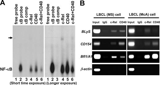 Figure 3. CD40 forms complexes with c-Rel on the promoters of proliferation and survival genes in LBCL cells. (A) Supershift analysis of c-Rel and CD40 proteins binding to the NF-κB site. LBCL cell (MS) nuclear extracts were incubated with the NF-κB cold probe or antibody against c-Rel and CD40 or both. A 32P-labeled NF-κB probe was then added to the reaction mixtures, and samples were analyzed by electrophoretic mobility shift assay (EMSA). comp indicates competition. Arrow indicates the supershift complex. (B) ChIP analysis was performed on 2 LBCL cell lines (MS and McA). The indicated antibodies were used to precipitate chromatin after cross-linking. PCR to detect the BLyS, CD154, Bfl1/A1, and β-actin promoter regions was performed on the precipitated DNA. IgG was used as a nonspecific antibody control.
