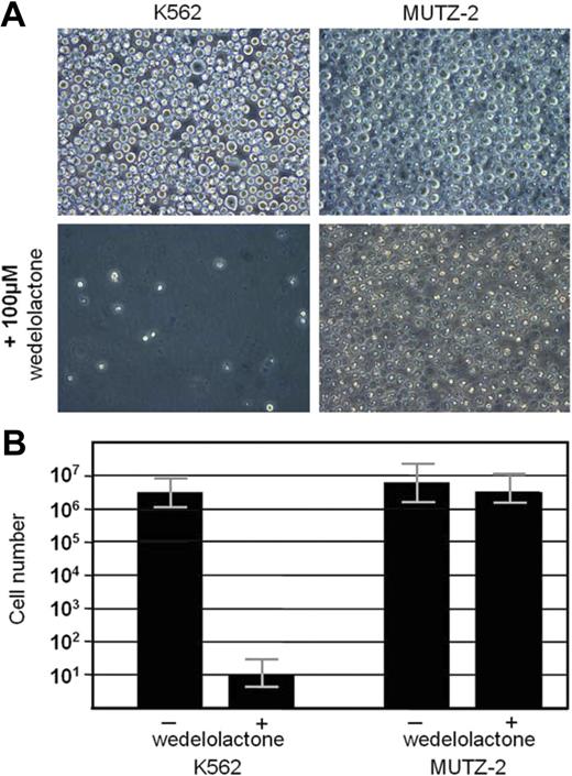 Figure 5. Effect of specific NF-κB inhibition on cell survival. After 4 days in culture, the NF-κB inhibitor, wedelolactone (100 μM). strongly inhibited cell survival in the CD56+ cell K562 but had no significant effect on the CD56(-)MUTZ-2 acute myeloid leukemia cells (mean ; SEM, triplicates). One representative experiment of 3. Slides were viewed through a Leica HCX microscope (Leica, Wetzlar, Germany) with a PL Fluotar L lens at 40×/0.60 corr PH2. Images were acquired with a Leica DMIL camera (Leica) and Olympus DP-Soft version 5.0 (Olympus) and processed using Adobe Photoshop version 3.0 (Adobe Systems).