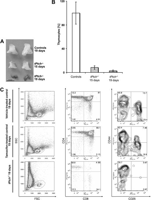 Figure 2. Thymus atrophy and loss of thymocytes in tPtch−/− mice. (A) Thymi from vehicle-treated control animals (top row) and thymus from tPtch−/− mice 15 and 19 days after the first tamoxifen injection (middle and bottom rows, respectively). (B) Fifteen and 19 days after tamoxifen injection, thymocyte numbers of tPtch−/− mice were determined by flow cytometry SSC versus FSC plot (n = 4 and n = 3, respectively) and are expressed as relative numbers compared with those obtained from control animals (n = 9 for tamoxifen- and n = 7 for vehicle-treated animals of both time points). Error bars represent standard deviation of the mean. (C) Thymocytes of tPtch−/− mice were prepared 19 days after the onset of tamoxifen treatment and analyzed by flow cytometry. Cells from vehicle-treated Ptchflox/floxERT2+/− and tamoxifen-treated Ptchflox/floxERT2−/− animals served as controls. Thymocytes within the lymphocyte fraction (SSC versus FSC, left panels) were analyzed by anti-CD4/anti-CD8 and anti-CD44/anti-CD25 stainings (middle and right panels, respectively). Relative percentages of the different thymocyte populations are indicated. Data are representative of 4 independent experiments (each experiment consisted of 1 vehicle-treated Ptchflox/floxERT2+/−, 1 tamoxifen-treated Ptchflox/floxERT2−/−, and 1 tPtch−/− mouse).