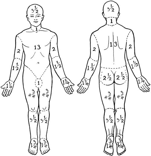Figure 1. Regional percent body surface area (BSA) in the adult. Adapted from Lund and Browder35 with permission.