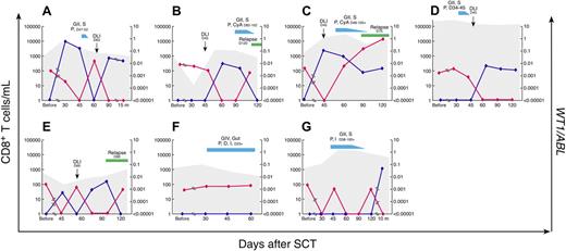Figure 4. WT1-specific CD8+ T-cell responses in peripheral blood in relation to disease response as measured by WT1/ABL gene expression. Results in 7 individual patients with detectable WT1 gene expression before SCT are shown (A, patient 1; B, patient 2; C, patient 3; D, patient 4; E, patient 5; F, patient 6; G, patient 7). The number of days after transplantation is shown on the x-axis. WT1/HLA-A*0201+ CD8+ T cells are expressed as absolute numbers/mL of peripheral blood (left, y-axis; dark blue); the shaded area represents absolute numbers of CMVpp65495/HLA-A*0201+ CD8+ T cells. WT1 gene expression in peripheral blood is expressed as the ratio of WT1/ABL (right, y-axis; red). Times of DLI (black arrow), GVHD (med blue), and relapse (green) are depicted on each graph. G indicates GVHD grade; S, skin; P, prednisone; m, months; CyA, cyclosporine A; D, dacluzimab; I, infliximab.