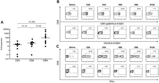 Figure 5. CMV-specific CD8+ T cells in patients and donors. (A) After SCT, patients have significantly greater frequencies of CMVpp65495/HLA-A*0201+ CD8+ T cells than donors and patients before SCT. Data from multiple time points after SCT are presented. (B) Longitudinal analysis of CMVpp65495/HLA-A*0201+ CD8+ T cells after SCT in patient 4. HIV/HLA-A*0201 was used as a negative control for tetramer staining. Results are expressed as percentages of CD8+ T cells. (C) Longitudinal analysis of IFN-γ production by CD8+ T cells in post-SCT PB samples from patient 4 cultured for 6 hours with CMV peptide (top panel) or without peptide (negative control, bottom panel). Results are expressed as percentages of CD8+ T cells.