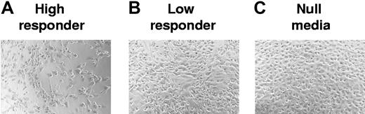 Figure 5. High CMV-specific T-cell frequency is associated with more endothelial damage. Endothelial cells were activated by either high- or low-responder supernatants from CMV-seropositive donors with high or low T-cell frequencies to CMV antigen. PBMCs were then added to these differentially activated endothelial cultures and allowed to adhere overnight. Nonadherent cells were removed the next day. The resulting cocultures were monitored for endothelial damage over the course of 6 days. (A) Damage results to endothelial monolayer activated using coculture supernatants from a high-responder donor. (B) Results from endothelial monolayers activated by a low-responder donor. (C) Results from resting-state, nonactivated endothelial cells. For image information, see Document S1 (available on the Blood website; see the Supplemental Materials link at the top of the online article.