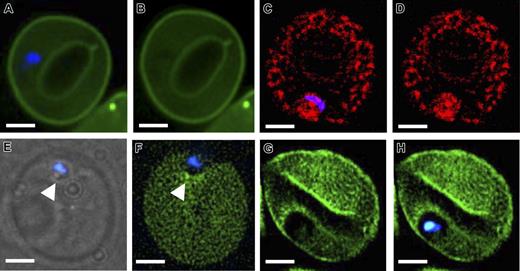Figure 4. PIP2 is absent from malaria-induced vacuoles. (A,B) Fluorescence micrographs of a GFP-PLCδ1 PH domain–loaded ghost (green) infected by a young ring-stage malaria parasite. The parasite nucleus is stained with blue Hoechst 33342 as shown in the merged image. Scale bar equals 2 μm. (C,D). Erythrocyte ghost loaded with Alexa-Fluor 594–labeled annexin V (red) containing a Hoechst-stained intracellular ring-stage parasite as shown in the merged image. Scale bar equals 2 μm. (E,F). Merozoite (blue) attached to the surface (as shown by light microscopy) (E) and indenting (arrowhead) the membrane of an erythrocyte ghost loaded with GFP-PLCδ1 PH domain (F). Scale bar equals 2 μm. (G-H). An erythrocyte ghost loaded with GFP-PLCδ1 PH domain (G) containing a recently invaded young ring-stage parasite (H) (merge with Hoechst stain). Images acquired with a 100×/1.35 oil objective (Olympus).