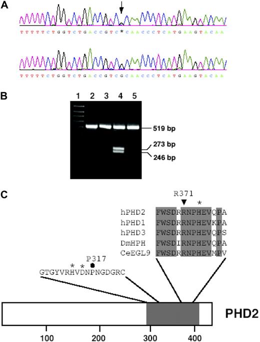 Figure 1. Identification of the 1112 G > A mutation in the PHD2 gene. (A) Detection of the G1112A mutation by PCR-direct sequencing. PCR was performed on total peripheral blood DNA using a set of primers to specifically amplify exon 3. Sequencing detected a heterozygous G-to-A change at base 1112 as indicated by an arrow (top panel) as compared with wild-type sequence (bottom panel). Shown are nucleotides 1093 to 1131. Bases are as follows: G, black; A, green; T, red; and C, blue. (B) Screening family members for G1112A mutation. The presence of A at base 1112 creates a restriction site for the enzyme Tsp45I to give 2 products of 246 bp and 273 bp from an exon 3 PCR product from the patient (lane 4). The mother of the patient (lane 3) was screened, and the absence of the 246 bp and 273 bp bands indicated she did not possess the G1112A mutation. Lane 1 contains a 100-bp DNA size marker; lane 2, nondigested exon 3 PCR product of 519 bp; and lane 5, Tsp45I-digested exon 3 PCR product from a control sample negative for the mutation as detected by sequencing. (C) Comparison of amino acid sequence from residues 366-379 (numbering according to hPHD2 nomenclature) in human HIF prolyl hydroxylases with those from D. melanogaster (DmHPH) and C. elegans (CeEGL9). Sequence shading indicates completely conserved residues. *Iron-chelating residue His-374. ▼ indicates Arg371 of human PHD2, which is predicted to be changed to His by the G1112A mutation. Also shown is hPHD2 sequence from residues 307-323. *Iron-chelating residues His313 and Asp315. ● indicates Pro317. The positions of these sequences in full-length hPHD2 is shown, with shading indicating prolyl hydroxylase domain. Numbers at bottom indicate residues.
