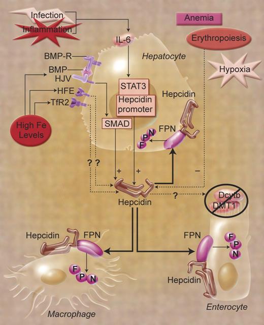 Central role of hepcidin in organismal iron homeostasis. Cell-associated, GPI-linked hemojuvelin (HJV) is proposed to act as a coreceptor for bone morphogenetic protein (BMP) ligands and BMP receptors (BMP-Rs). Interaction of HJV with BMP ligands and 2 BMP-Rs on the cell surface generates an active signaling complex. This complex subsequently activates the intracellular SMAD signaling pathway to induce hepcidin expression. Hepcidin, a peptide secreted by the liver, promotes internalization and degradation of the iron exporter ferroportin (FPN). The pathway by which HFE and transferrin receptor 2 (TfR2) control the expression of hepcidin is unclear. Importantly, mutations in HJV, HFE, or TfR2 lead to inappropriately low levels of hepcidin. Dcytb indicates duodenal cytochrome b; DMT1, divalent metal transporter 1. This figure is a modified version of that published in Dunn et al,2 copyright Elsevier; adapted with permission by Alice Y. Chen.