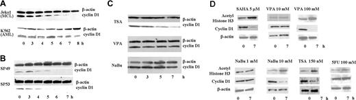Figure 1. SAHA rapidly decreased cyclin D1 protein in MCL cells. (A) Jeko1 cells (MCL line) and K562 cells (AML line) and (B) 2 other MCL cell lines (SP49, SP53) were cultured with SAHA (5 μM) for the indicated times, and cyclin D1 and β-actin protein levels were measured by Western blot analysis. (C) Jeko1 cells were treated with either TSA (150 nM), VPA (5 mM), or NaBu (1 mM) for the indicated times and analyzed for expression of cyclin D1 and β-actin by Western blot. (D) Jeko 1 cells were treated with HDAC inhibitors (SAHA, VPA, NaBu, TSA) or 5FU at indicated concentrations for 7 hours. Levels of cyclin D1, acetyl-histone H3 (a known target of SAHA), and β-actin (loading control) were examined by Western blot analysis.