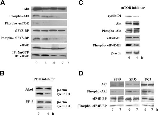 Figure 6. SAHA diminished Akt/mTOR/eIF4E-BP/eIF4E signal pathway, and a PI3K inhibitor, LY294002, decreased cyclin D1 protein levels in MCL cells. (A) Jeko1 cells were cultured with SAHA (5 μM) for the indicated times. Levels of phospho-Akt, Akt, phospho-mTOR, phospho-eIF4E-BP, eIF4E-BP, eIF4E, and active eIF4E (bottom; see “Materials and methods, Immunoprecipitation and Western blot analysis”) were detected by Western blot analysis. (B) 2 MCL lines (Jeko1 and SP49) were treated with the PI3K inhibitor, LY294002 (50 μM) for 4 hours. Levels of cyclin D1 were determined by Western blot analysis. β-Actin was used as an internal control. (C) Jeko 1 cells were treated with the mTOR inhibitor RAD001 (200 nM) for 4 hours. Levels of cyclin D1, Akt, phospho-Akt, eIF4E-BP, and phospho-eIF4E-BP were detected by Western blot analysis. (D) 2 additional MCL lines (SP49, SP53) and a prostate cancer cell line PC3, in which Akt/mTOR/eIF4BP pathway is active because the PI3K inhibitory protein (PTEN) is deleted, were treated with SAHA (5 μM, 7 hours). Phosphorylation status of Akt and eIF4E-BP as well as whole Akt and eIF4E-BP levels were examined by Western blot. SAHA treatment decreased phosphorylated Akt and eIF4E-BP, whereas total levels of these proteins were not affected.