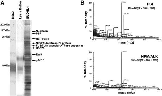 Figure 1. Identification of proteins coimmunoprecipitating with NPM/ALK by mass spectrometry. (A) Silver-stained SDS-PAGE gel of anti-ALK1 immunoprecipitates from NPM/ALK− K562 cells (lane 1), lysis buffer alone (lane 2), and NPM/ALK+ SUDHL-1 cells (lane 3). Bands were excised from the gel, trypsin-digested, and analyzed by MALDI-TOF. Identified proteins are indicated by arrows. (B) MS/MS sequencing of peptides identifying PSF (GenBank accession no. P23246) and NPM/ALK (GenBank accession no. AAA58698) proteins.