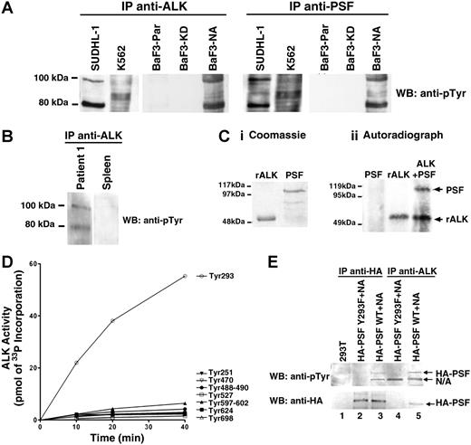 Figure 3. PSF is tyrosine-phosphorylated in NPM/ALK-expressing cells and is a substrate of ALK tyrosine kinase activity. (A) Anti-ALK1 and anti-PSF immunoprecipitates (IPs) from SUDHL-1, K562, BaF3-Par, BaF3-KD, and BaF3-NA cells were Western blotted with an antiphosphotyrosine (anti-pTyr) antibody. (B) Anti-ALK1 immunoprecipitates from lymph nodes derived from patient 1 with NPM/ALK+ ALCL and NPM/ALK− spleen tissue were Western blotted using the anti-pTyr antibody. (C) A radioactive in vitro kinase assay was performed with purified recombinant 6xHisALK kinase domain (rALK) and purified full-length 6xHis-PSF. Protein purity was checked by coomassie staining (Ci). Kinase assay was performed in the presence of rALK kinase domain alone (0.4 μg), PSF alone (0.25 μg), or rALK and PSF together. Samples were analyzed by SDS-PAGE and visualized by autoradiography (Cii). Bands corresponding to PSF and ALK are indicated by arrows. (D) Time courses of the phosphorylation of PSF peptides (400 μM) by GST-ALK. The peptide sequences are as follows: Tyr251, RGGRQHHPPYHQQHHQGP; Tyr293, PGEKTYTQRCRLFVGNLPADIT; Tyr470, EKLAQKNPMYQKERETPTR; Tyr488-490, TFEYEYSQRWKSLDEMEKQQR; Tyr527, EMEDAYHEHQANLLRQDLMRRQ; Tyr597-602, REESYSRMGYMDPRERDMR; Tyr624, MNMGDPYGSGGQKFPPLGGG; and Tyr698, GRGREEYEGPNKKPRF (target tyrosine in bold). (E) Immunoprecipitation with anti-HA (lanes 2,3) and anti-ALK1 (lanes 4,5) monoclonal antibodies of lysate derived from 293T cells transiently transfected with wild-type or mutant Y293F HA-PSF together with NPM/ALK. Immunoprecipitates were resolved by SDS-PAGE, and Western blotting with anti-pTyr and anti-HA antibodies was performed. Lane 1 shows lysate from nontransfected 293T cells.