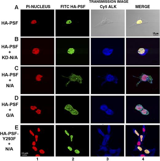 Figure 4. PSF is delocalized to the cytoplasm in cells expressing ALK fusion proteins. Indirect immunofluorescence was performed on 293T cells transiently transfected with HA-PSF alone, or together with kinase-dead NPM/ALK (KD-N/A), NPM/ALK (N/A), GCN4/ALK (G/A), or with mutant HA-PSF-Y293F together with NPM/ALK (N/A). Fluorescence was detected by confocal microscopy. Nuclei were detected using propidium iodide (PI) shown in red (column 1). HA-PSF was detected by FITC staining shown in green (column 2). NPM/ALK was detected by Cy5 staining shown in blue (column 3). A transmission image in place of Cy5 staining is shown for cells transfected with HA-PSF alone. Images were acquired using a Nikon 60×/1.4 NA oil-immersion objective lens, a medium solution of 95% glycerol in PBS, and a Biorad Laser Sharp 2000 camera; image processing was done with Adobe Photoshop CS2 version 9.0.