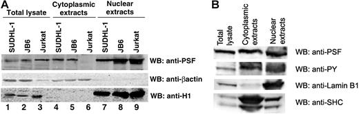 Figure 5. PSF content in cytoplasmic and nuclear extracts derived from human cell lines. Nuclear and cytoplasmic extracts were prepared from the NPM/ALK− cell line, Jurkat, and the NPM/ALK+ cell lines, SUDHL-1 and JB6. (A) Total cell lysates (lanes 1-3), cytoplasmic extracts (lanes 4-6), and nuclear extracts (lanes 7-9) were resolved by SDS-PAGE, and PSF was detected by Western blotting (top panel). The purity of the extracts were controlled by Western blotting with anti-β-actin for the cytoplasm (middle panel) and anti-histone H1 for the nucleus (bottom panel). (B) Nuclear and cytoplasmic extracts from SUDHL-1 cells were probed with antiphosphotyrosine antibody.