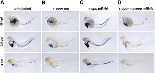 Figure 4. Loss of EpoR decreases primitive and blocks definitive erythropoiesis. beta e1-globin expression in (A) uninjected, (B) epor MO–injected, (C) epo mRNA–injected, and (D) epor MO:epo mRNA–injected embryos at 36 hpf, 2.5 dpf, and 4 dpf. Embryos injected with epor MO show a slight decrease in erythropoiesis beginning at 36 hpf, and by 4 dpf there is a complete absence of circulating erythrocytes. Injection of epo mRNA alone causes a progressive increase in the number of beta e1-globin+ cells in circulation throughout ontogeny. To demonstrate that epo and the epor are a functional ligand-receptor pair, epor MO was coinjected with epo mRNA. Loss of EpoR effectively blocks the expansion of erythrocytes by epo overexpression as shown by a decrease in beta e1-globin+ cell numbers. Lateral views, anterior to the left.
