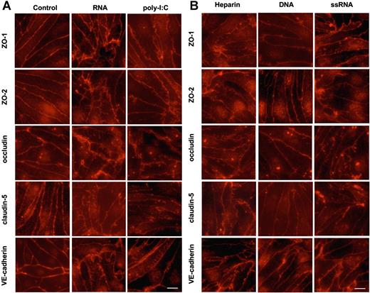 Figure 2. Disintegration of endothelial monolayers mediated by extracellular nucleic acids. Confluent BMECs, cultured on rat tail collagen I–coated coverslips, were incubated for 3 hours in the absence (control) or presence of RNA (50 μg/mL), poly-I:C (25 μg/mL), heparin (10 μg/mL), DNA (25 μg/mL), or ssRNA (0.25 μg/mL), fixed, and stained with the corresponding antibodies against the indicated junctional proteins. Note the disintegration of intercellular junctions and the changed cellular distribution of ZO-1, ZO-2, occludin, claudin-5, and VE-cadherin following treatment of cells with RNA, poly-I:C, heparin, and ssRNA, but not DNA. Scale bar equals 10 μm, magnification was 63×/1.32-0.6 (oil objective). Images were taken using a Wisitron Systems GmbH (Puchheim, Germany) and analysed by image-acquisition software MetaMorph, version 7 (Molecular Devices, Berkshire, United Kingdom).