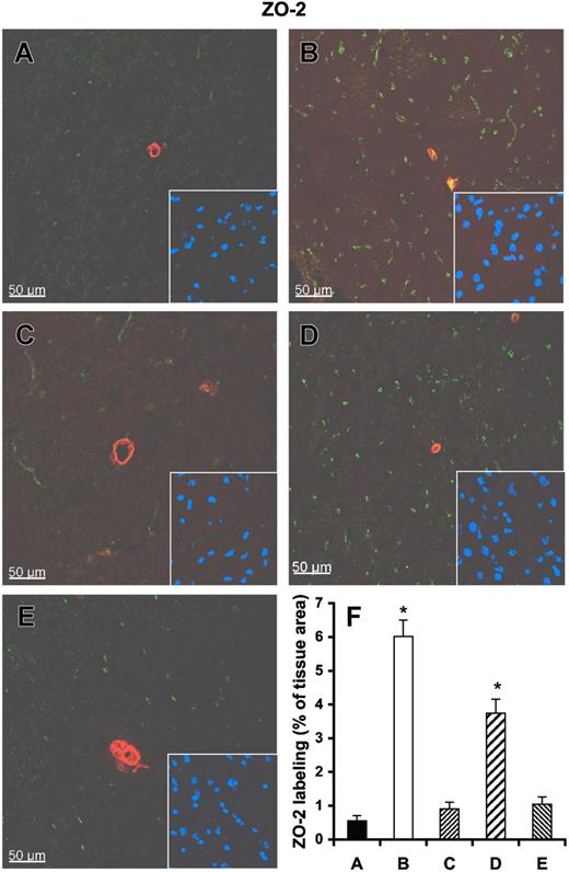 Figure 7. Influence of RNase on vessel integrity in infarcted brain tissue. Tissue cryosections of rat brains after middle cerebral artery occlusion were prepared from infarcted brain pretreated with either saline control (A), heparin (C), RNase (D), or DNase (E), or from noninfarcted brain areas (B). All sections were stained with a polyclonal antibody against ZO-2 (green fluorescence) and with a monoclonal antibody against α-smooth muscle actin (red fluorescence). Staining of the nuclei in the corresponding area is shown in the right corner of each panel. (F) Quantitative analysis of ZO-2 demonstrates that ZO-2 staining is dramatically reduced in infarcted brain areas (A), which is significantly restored after RNase pretreatment (D). Values represent the mean (± SEM; n = 6; *P < .001 versus group A = control), magnification was 40×/1.00-0.5 NA objective (Leica).