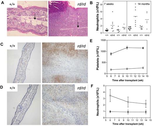 Figure 2. Spontaneous inflammatory disease in Wdr1 mutant mice. (A) Hematoxylin and eosin–stained ear sections showing the epidermal hyperplasia and leukocytic infiltration characteristic of inflamed ears, with the cartilaginous scaffold of the ear indicated (black arrow). To illustrate the scale of the ongoing inflammatory process, wild-type and rd/rd images were taken at 200 × and 100 × magnification, respectively. (B) Peripheral blood neutrophil numbers are elevated in Wdr1rd/rd mice compared with wild-type littermates. Individual male (■+/+, □ rd/rd) and female (● +/+, ○ rd/rd) mice are shown. (C) Anti-Gr1 immunohistochemistry on frozen sections of ear demonstrating the presence of large numbers of neutrophils within the lesion. (D) Anti-F4/80 immunohistochemistry demonstrating that macrophages are also present within the inflammatory lesion. Isotype controls for both Gr1 and F4/80 exhibited no staining (data not shown). (E,F) Peripheral blood platelet (E) and neutrophil (F) numbers in lethally irradiated recipients of wild-type or Wdr1rd/rd bone marrow (■+/+, □ rd/rd). The CD45.1/CD45.2 leukocyte polymorphism system was used to distinguish donor from recipient hematopoiesis. Donor engraftment levels, as measured by contribution to peripheral blood leukocytes, were more than 90% in each recipient; n = 8 recipient mice per donor genotype. Data shown in (E,F) represent the mean plus or minus a standard deviation.