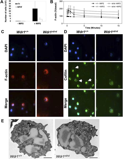 Figure 3. Wdr1 deficiency causes cytoskeletal defects in neutrophils. (A) Neutrophil chemotaxis toward MIP-2 in 3-micron transwells, demonstrating defective migration of Wdr1rd/rd neutrophils. (B) Basal and MIP-2–stimulated actin polymerization, showing elevated resting filamentous actin levels and impaired actin depolymerization rates in Wdr1rd/rd neutrophils. Data shown represent the means plus or minus a standard deviation; n equals 6 mice per genotype. (C) Fluorescence microscopy showing the cellular distribution of filamentous actin in neutrophils. In wild-type cells, filamentous actin is distributed throughout the cytosol and is more concentrated at the cell cortex. In Wdr1rd/rd neutrophils, the formation of filamentous actin is enhanced with no obvious cortical actin. (D) Cellular localization of cofilin in neutrophils. In wild-type cells, cofilin is localized to the nucleus and to the periphery (white arrows). In contrast, in Wdr1rd/rd neutrophils cofilin is delocalized from the cell cortex and becomes diffused throughout the cytosol. (E) Transmission electron microscopy of peripheral blood neutrophils. No gross morphologic changes were seen in Wdr1rd/rd neutrophils. Scale bar indicates 1 μm.