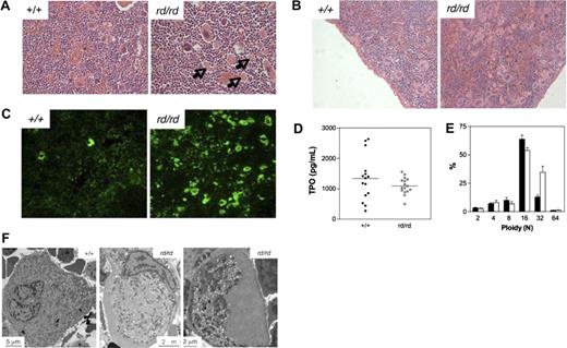 Figure 5. Defective megakaryocytopoiesis in Wdr1rd/rd mice. (A,B) Hematoxylin and eosin stained spleen sections illustrating megakaryocytosis in the bone marrow (A) and spleen (B) of Wdr1rd/rd mice. Arrows indicate examples of the fragments of megakaryocyte cytoplasm observed. (C) Anti-CD41 immunofluorescence of frozen sections, demonstrating the presence of many fragments of megakaryocyte cytoplasm in the spleen of Wdr1rd/rd mice. (D) Serum thrombopoietin levels as measured by enzyme-linked immunosorbent assay in 12-week-old male mice. Horizontal bars indicate the mean. (E) Ploidy distribution of bone marrow megakaryocytes demonstrating a shift toward 32N in Wdr1rd/rd mice; n equals 12 male mice per genotype. Solid bars represent the mean; errors bars, standard deviation. (F) Transmission electron microscopy studies of bone marrow megakaryocytes. A typical mature wild-type megakaryocyte is shown at left. In contrast, Wdr1rd/rd megakaryocytes are smaller and exhibit gross abnormalities, particularly failure of the demarcation membrane system to develop, and large peripheral zones devoid of organelles and granules. The Wdr1rd/rd megakaryocyte shown in the right panel contains no nucleus; this class of cell constituted approximately 25% of the more than 60 individual Wdr1rd/rd megakaryocytes that were viewed. It may be representative of the abundant cytoplasmic fragments seen in the bone marrow and spleen of Wdr1rd/rd mice.