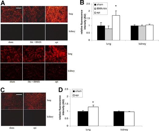 Figure 4. Epinephrine increases SS RBC organ sequestration. (A,B) SS RBCs were sham treated, fsk + IBMX treated, or epi treated. Sham-treated SS RBCs were detected to some degree in the lung but only minimally in the kidney. Treatment with fsk + IBMX did not significantly increase SS RBC trapping in the lung or kidney, and epi treatment led to significant increases in RBCs trapping only in the lung. Error bars show SEM of 3 different experiments. *P < .05 compared with sham-treated. The 2 parts in panel A represent 2 different experiments with similar results. (C,D) Normal RBCs were sham treated or epi treated. Epi treatment only had a significant effect on trapping of normal RBCs in the lung compared with sham-treated cells. Error bars show SEM of 3 different experiments. *P < .05 compared with sham-treated. Scale bar = 100 μm.