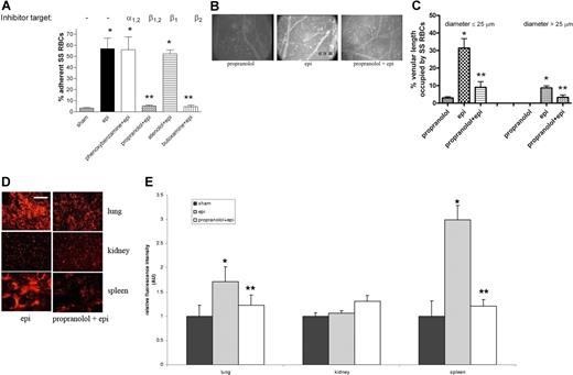 Figure 5. Effect of propranolol on epinephrine-induced SS RBC adhesion and organ sequestration. (A) β- and β2-AR antagonists abolish epi-induced SS RBC adhesion to HUVECs in vitro at a shear stress of 2 dynes/cm2. SS RBCs were sham treated, epi treated, or pretreated with phenoxybenzamine, propranolol, atenolol, or butoxamine followed by treatment with epi (n = 3 each). Error bars show SEM of 3 different experiments. *P < .01 compared with sham-treated; **P < .001 compared with epi-treated. (B) In vitro propranolol treatment had no effect on SS RBC adhesion (n = 5) in vivo, whereas epi dramatically increased SS RBC adhesion and vaso-occlusion to venule walls (n = 5). Propranolol treatment of SS RBCs significantly reduced subsequent epi-stimulated adhesion and stasis (n = 5). (C) Effect of propranolol on percent venular length occupied by SS RBCs. Video frames showing more than 30 vessel segments were used to quantify the length of venules occupied by SS RBCs in animals infused with SS RBCs treated as described for panel A (n = 5 for each treatment). The values were averaged among groups of animals to represent the mean percent venular length occupied by SS RBCs. Error bars show SEM. *P < .01 compared with propranolol-treated RBCs for vessels up to 25 μm in diameter, and P < .001 for vessels more than 25 μm in diameter. **P < .01 compared with epi-treated RBCs regardless of the vessel diameter. (D-E) SS RBCs were epi treated or propranolol + epi treated. Epi-treated SS RBCs were extensively trapped in the lung and spleen. Propranolol significantly reduced epi-treated SS RBC trapping in the lung and spleen. SS RBC trapping in the kidney was similar for all cell preparations. Error bars show SEM of 5 different experiments. *P < .05 compared with sham-treated (not pictured); **P < .05 compared with epi-treated. Scale bar = 100 μm.