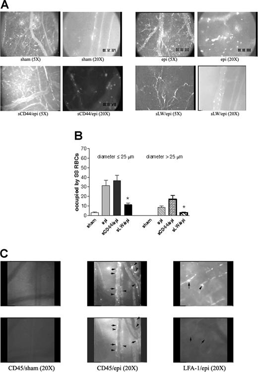 Figure 6. Epinephrine-activated SS RBCs adhere through LW and induce activation and adhesion of murine leukocytes. (A-B) Epinephrine-induced SS RBC adhesion and vaso-occlusion are mediated via LW. (A) Inhibition of SS RBC adhesion with soluble proteins was performed as described in “Material and methods.” Sham-treated SS RBCs showed little adhesion to vessel walls, whereas epi-treated SS RBCs showed marked adhesion to postcapillary venules, with intermittent vaso-occlusion. Infusion of sCD44 (as a negative control) 30 minutes prior to intravenous administration of epi-treated SS RBCs (n = 5) had no effect on epi-treated SS RBC adhesion to postcapillary venules, whereas infusion of sLW 30 minutes prior to injection of epi-treated SS RBCs (n = 5) markedly inhibited adhesion to postcapillary vessels. (B) Involvement of LW in SS RBC adhesion to endothelium and vaso-occlusion. Animals were infused with sham- or epi-treated SS RBCs 30 minutes after intravenous administration of sCD44 or sLW (n = 5 for each treatment). Thirty segments of venules were analyzed to quantify the length of venules occupied by SS RBCs. The values were averaged among groups of animals to represent the mean percent venular length occupied by SS RBCs. Error bars show SEM of 5 different experiments. *P < .001 compared with sCD44/epi-treated (animals/cells) for vessels up to 25 μm in diameter, and P < .05 for vessels more than 25 μm in diameter. (C) Epi-activated human SS RBCs induce adhesion of murine leukocytes to endothelium. Fluorescently labeled (red) sham- (n = 3) and epi-treated SS RBCs (n = 3) were infused 30 minutes after injection of rat FITC-labeled antimouse CD45 or LFA-1 antibodies. In the presence of epi-treated human SS RBCs, murine leukocytes adhered to postcapillary endothelium, and this adhesion was blocked by antibody against mouse LFA-1. Arrows indicate identical areas visualized with filters for red and green fluorescence to show where human SS RBCs and murine leukocytes are adherent to endothelium. In some areas, both murine leukocytes and human SS RBCs were adherent, whereas in other areas only one adherent cell type was present. Top panels show adhesion of human SS RBCs, bottom panels show adhesion of murine leukocytes.
