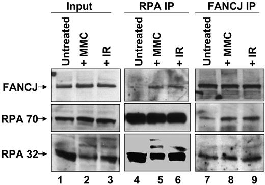 Figure 3. Coimmunoprecipitation of FANCJ and RPA after DNA damage. Nuclear extracts were prepared from HeLa cells that were untreated or exposed to IR (10 Gy) or MMC (500 ng/mL) and immunoprecipitated with anti-FANCJ or anti-RPA antibody as indicated. The blot was probed with rabbit anti-FANCJ (top) and mouse anti-RPA70 or anti-RPA32 (bottom) antibodies.