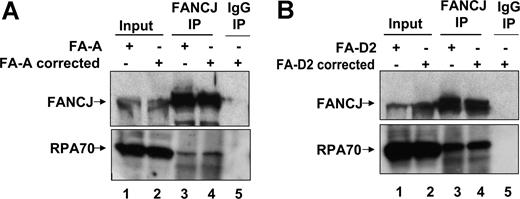 Figure 4. FANCJ-RPA interaction is intact in FA mutant cells coimmunoprecipitation of FANCJ and RPA in FA-A and FA-D2 cells. Coimmunoprecipitation of RPA with FANCJ in FA-A vector and FA-A corrected cells (A) or FA-D2 vector and FA-D2–corrected cells (B) with the use of FANCJ antibody. The blot was probed with rabbit anti-FANCJ (top) and mouse anti-RPA (bottom) antibodies. Input represents 15% of WCE input for coimmunoprecipitation experiments. Control immunoprecipitate from WCE of FA-A–corrected or FA-D2–corrected cells with the use of normal rabbit IgG is shown in lane 5.