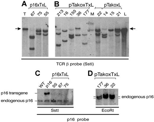 Figure 4. T-ALLs from TAL1xLMO1xp16INK4A mice express clonal TCRβ rearrangements and p16INK4A transgene chromosomal deletion. (A,B) TCRβ rearrangements in tumor DNA from our different models are detected by Southern blot after SstI digestion (1 experiment). Germ line bands are indicated with arrows, and tumor samples are identified using unique sample numbers. The numbers 67, 75, and 55 are p16TLM leukemias; 213, 16, 155, 36, 177, and 22 are TLMpTαko leukemias; and 14, 15, and 21 LMO1 are pTαko leukemias. T indicates tail; L, liver (germ line control); and M, size marker. (C,D) Southern-blot analysis of p16 locus configuration using p16 probe and SstI (C) or EcoRI (D) digests of DNA. (Cross hybridization occurs between human and mouse.) Tumor samples are identified as in panels A and B. DNA from WT, p16 transgenic mice are used as controls. Bands corresponding to the human transgene and to the endogenous locus are shown (1 experiment).