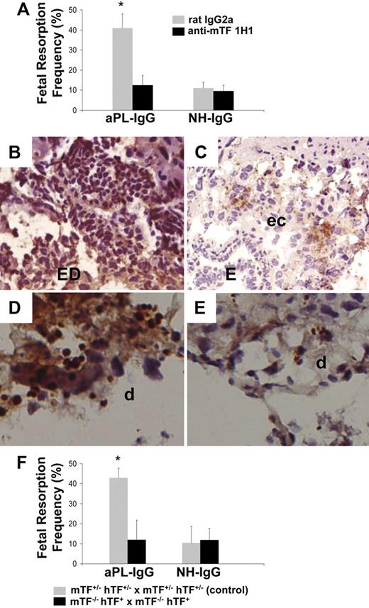 Figure 2. Inhibition of TF activity protects embryos from aPL-induced inflammation and embryonic death. (A) Pregnant female mice treated on days 8 and 12 with aPL-IgG received either an anti-TF mAb (1H1) or a rat IgG2a. On day 15 of pregnancy, mice were killed, uteri were dissected, and fetal resorption rates calculated (number of resorptions/number of fetuses + number of resorptions). There were 6 to 8 mice in each group. Mice that received aPL-IgG had a high frequency of fetal resorption compared with those that received normal human IgG (P < .001). Treatment with anti-TF mAb 1H1 led to a significant reduction in the frequency of fetal resorption compared with those mice receiving aPL-IgG (P < .01). Error bars here and in panel F are SD. (B,C) Immunohistochemical analysis of C3 in sections of deciduas from mice treated with either aPL-IgG + IgG2a or aPL-IgG + anti-TF antibody. (B) In deciduas from aPL-IgG + IgG2a–treated mice, C3 deposits (brown) were present throughout decidual tissue surrounding the necrotic residual embryonic debris (ED). (C) In contrast, in mice treated with aPL-IgG plus anti-TF antibody, C3 deposition was less intense and limited to the ectoplacental cone (ec) and the embryos remained intact (E). (D,E) Immunohistochemical analysis for neutrophils in sections of deciduas from aPL-IgG and aPL-IgG + anti-TF mAb 1H1. (D) Intense staining for neutrophils (brown) was observed in deciduas from mice treated with aPL-IgG plus IgG2a. In contrast, less neutrophil infiltration was observed in deciduas from mice that had received aPL-IgG + anti-TF mAb 1H1 (E). Counterstain: hematoxylin. Original magnification × 500. (F) Pregnant mice expressing low levels of TF (mTF−/−,hTF+) were treated on days 8 and 12 with aPL-IgG or NH-IgG. On day 15, fetal resorption rates were calculated. Approximately 40% of the embryos in control mice (mTF+/−,hTF+) treated with aPL-IgG were resorbed. Mice expressing low activity of TF showed a reduction in aPL-induced fetal resorption frequency compared with control mice (*P < .001).